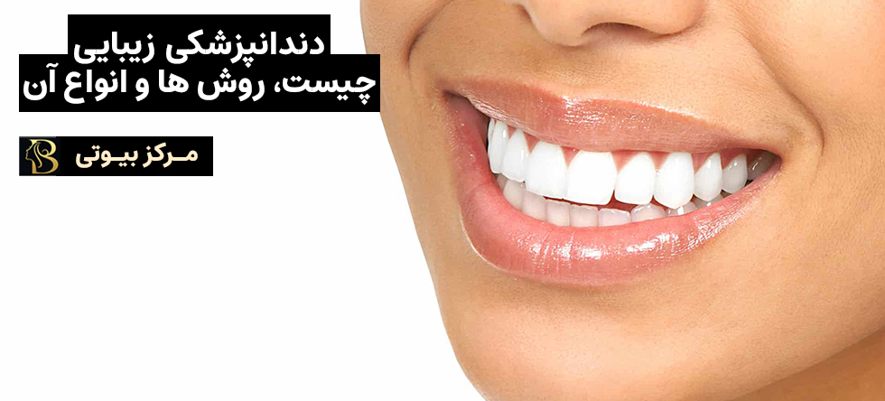 دندانپزشکی زیبایی: چیست، روش ها و انواع | مرکز بیوتی