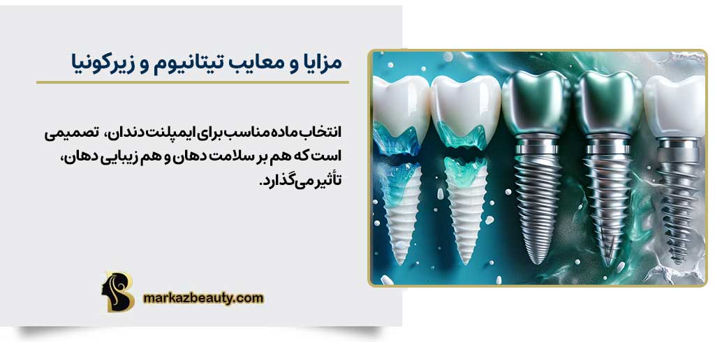 مزایا و معایب ایمپلنت تیتانیومی و ایمپلنت زیرکونیا | مرکز بیوتی 