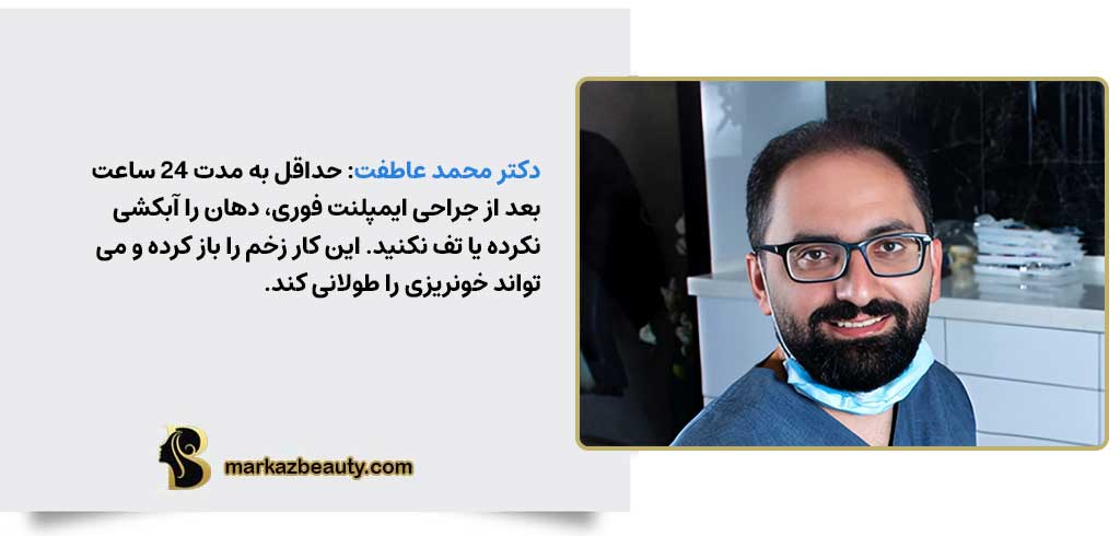 مراقبتهای بعد از ایمپلنت دندان فوری | مرکز بیوتی
