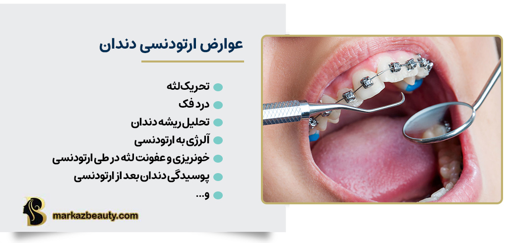 آیا ارتودنسی عوارض دارد؟ | مرکز بیوتی