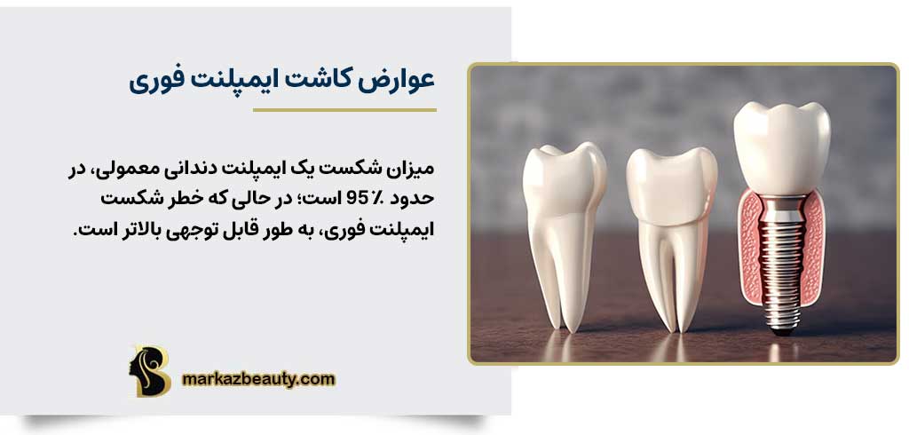 عوارض کاشت ایمپلنت فوری | مرکز بیوتی