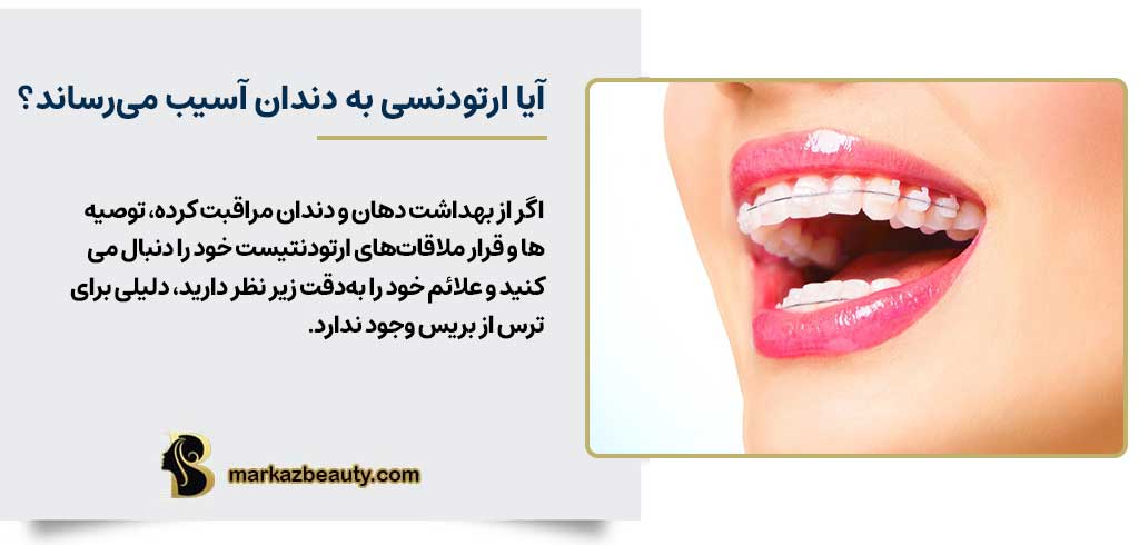 آیا بریس‌ها به دندان‌ها آسیب می‌رسانند؟ | مرکز بیوتی