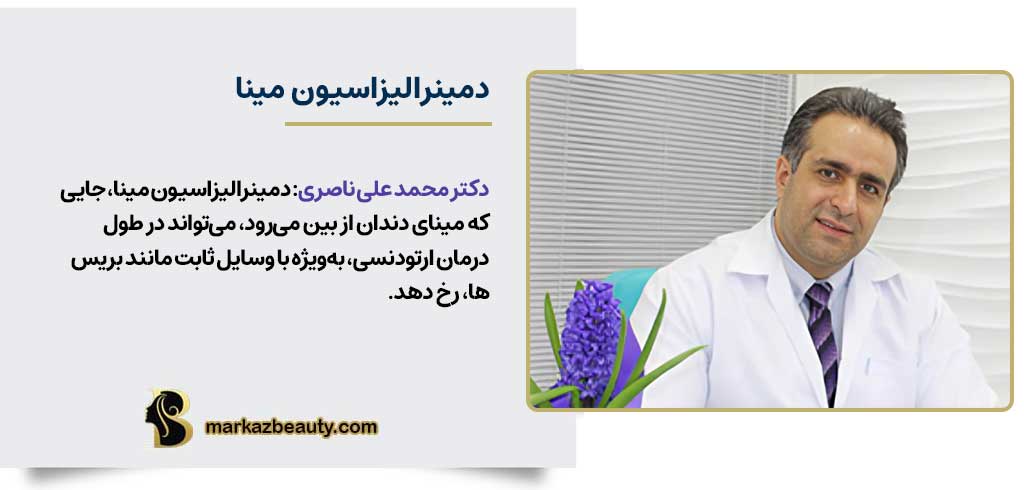 دمینرالیزاسیون مینا از عوارض ارتودنسی دندان | عوارض ارتودنسی دندان