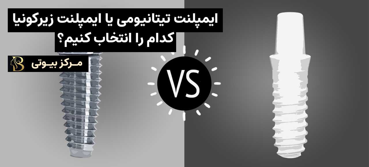 ایمپلنت تیتانیومی یا ایمپلنت زیرکونیا | کدام را انتخاب کنیم؟ | مرکز بیوتی