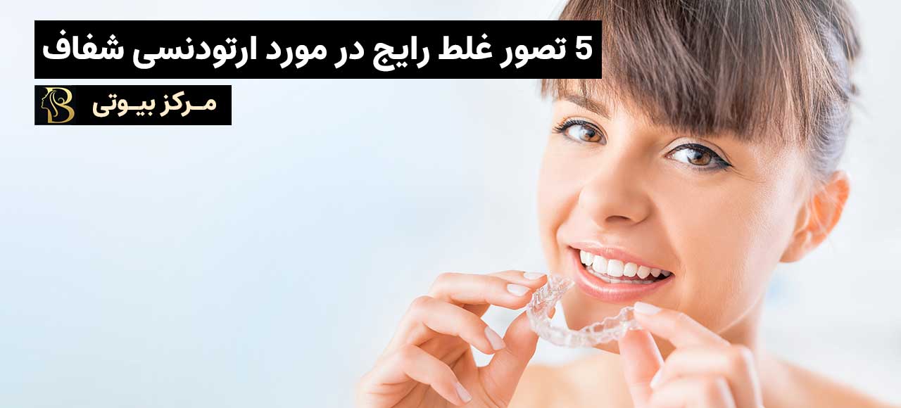 5 تصور غلط رایج در مورد ارتودنسی شفاف | مرکز بیوتی