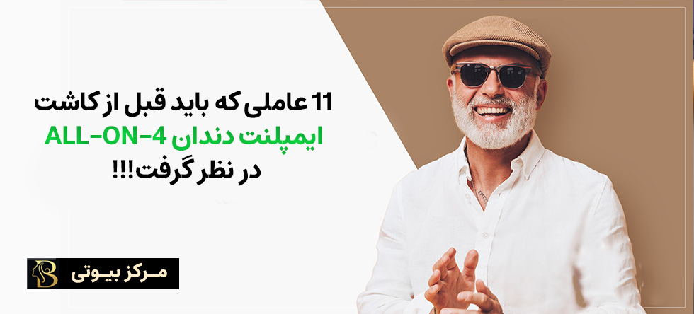 11 عاملی که باید قبل از کاشت ایمپلنت دندان All-On-4 در نظر گرفت!!! | مرکز بیوتی