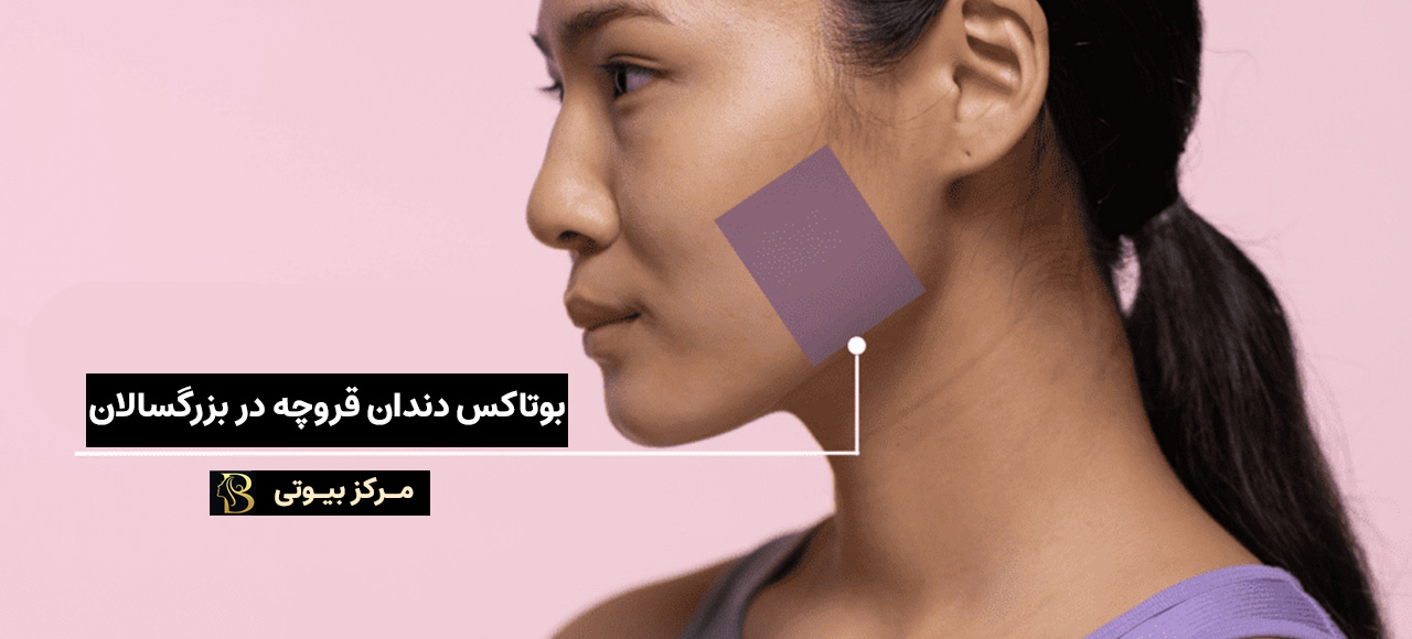 بوتاکس دندان قروچه در بزرگسالان | مرکز بیوتی