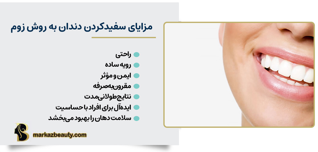 مزایای سفیدکردن دندان به روش زوم | مرکز بیوتی