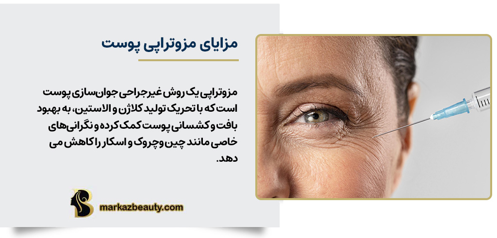 مزایای مزوتراپی پوست | مرکز بیوتی