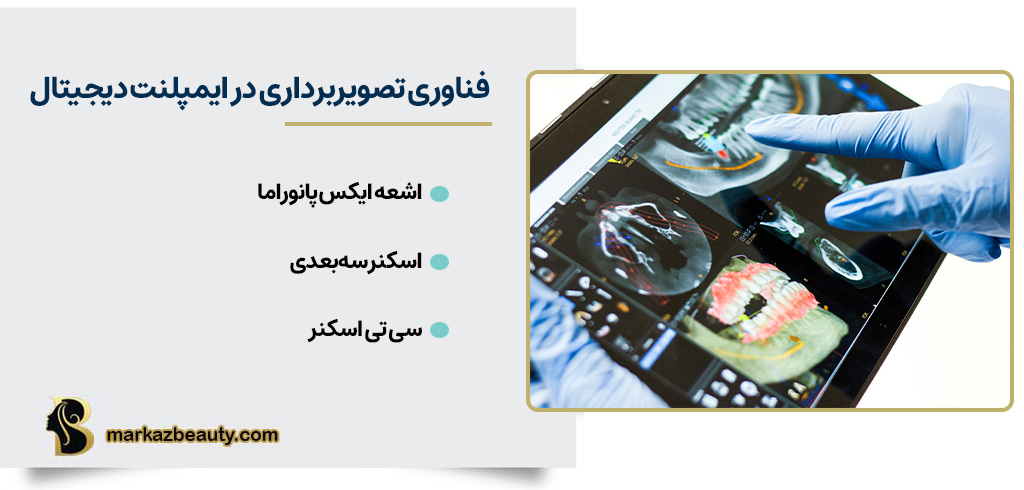 فناوری تصویربرداری در ایمپلنت دیجیتال | مرکز بیوتی