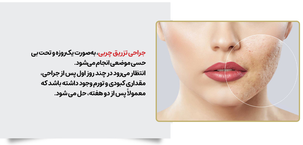 بازیابی و دوران نقاهت پیوند چربی صورت | مرکز بیوتی