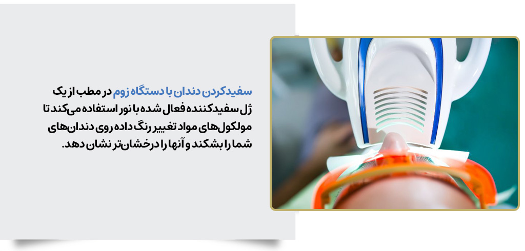 سفیدکردن دندان با دستگاه زوم | مرکز بیوتی