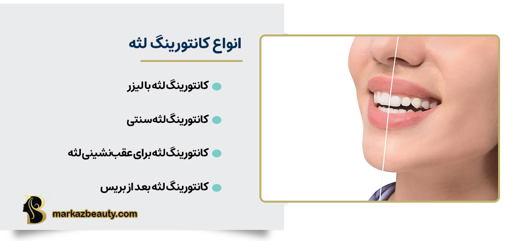 انواع کانتورینگ لثه | مرکز بیوتی
