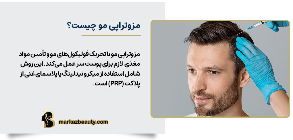 مزوتراپی مو چیست؟ | مرکز بیوتی
