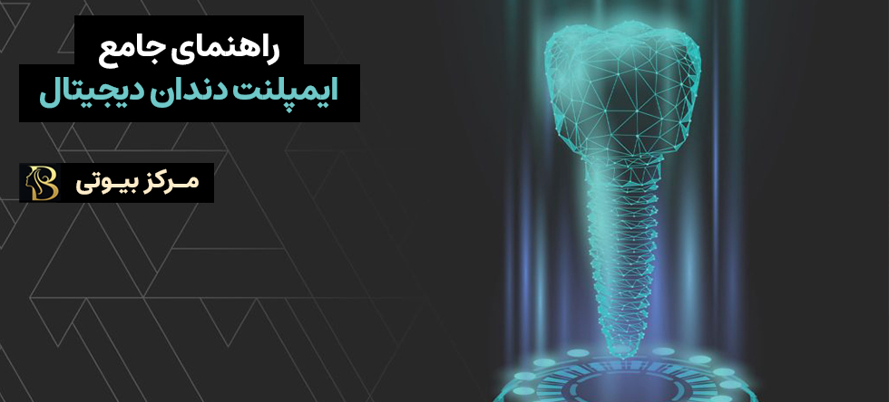 راهنمای جامع ایمپلنت دیجیتال | باید بدانید! | مرکز بیوتی