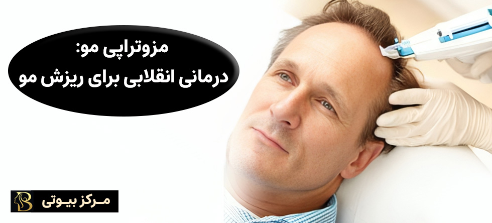 مزوتراپی مو: درمانی انقلابی برای ریزش مو | مرکز بیوتی