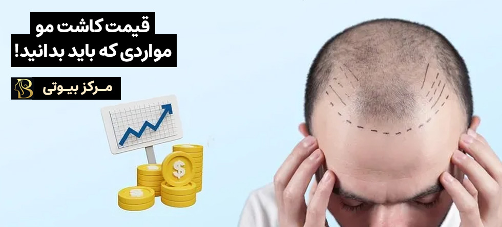 قیمت کاشت مو | مواردی که باید بدانید!