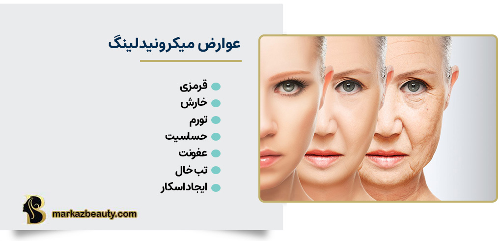 عوارض میکرونیدلینگ | مرکز بیوتی