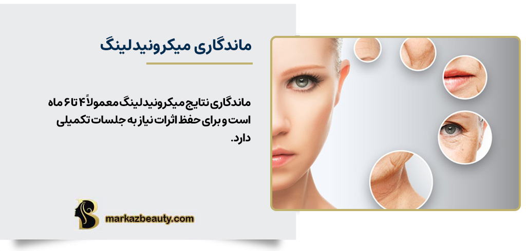 ماندگاری نتایج میکرونیدلینگ چقدر است؟ | مرکز بیوتی