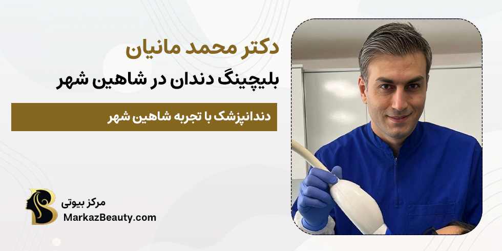 محمد مانیان (دکتر بلیچینگ دندان شاهین شهر) | مرکز بیوتی