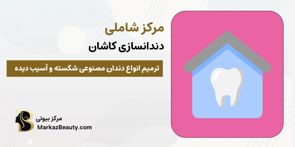 لابراتوار دندانسازی شاملی (دندانساز خوب در کاشان) | مرکز بیوتی