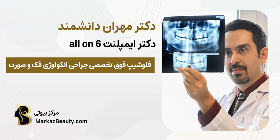 دکتر مهران دانشمند (متخصص ایمپلنت all on 6 اصفهان) | مرکز بیوتی